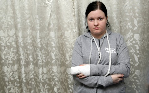 В первый день работы кировчанке станком отрезало фалангу пальца