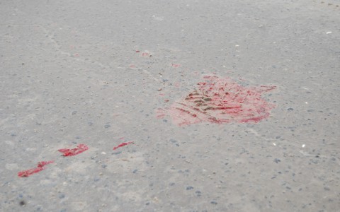 В Кирове  в районе Зонального института сбили женщину