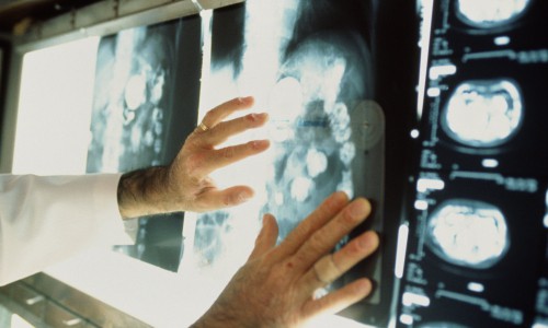 Десять обследований, которые можно пройти бесплатно в 2015 году