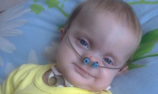 В Кирове полуторагодовалая малышка не может говорить и самостоятельно дышать