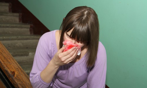 В кировском общежитии 25-летняя  женщина откусила нос своей соседке