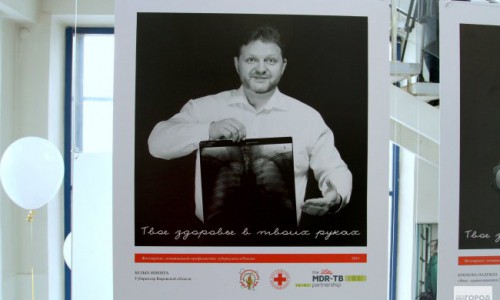 Фоторепортаж: в Кирове открылась выставка рентгеновских снимков известных людей