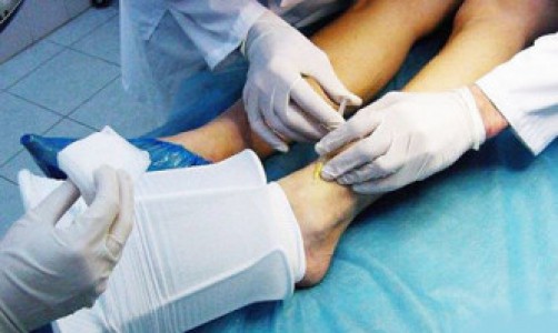 Эстетическая склеротерапия – это не страшно