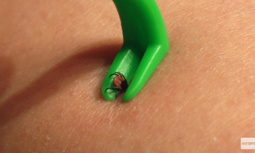 В Кировской области от укусов клещей пострадали 33 человека