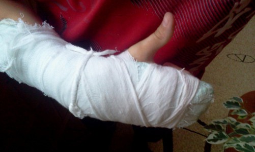 В Курской области жених из Кирова покусал полицейского