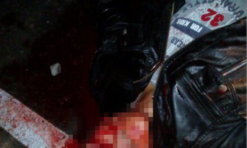 В Кирове на Победиловском тракте насмерть сбили велосипедиста (Осторожно, шокирующее фото)