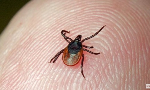 В Кировской области после укуса клеща уже заболели более 200 человек