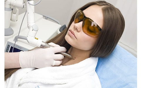 Удаление новообразований кожи радиохирургическим методом