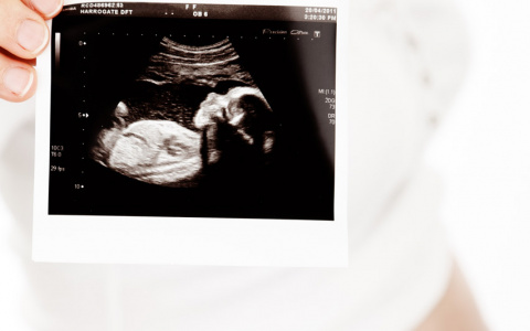 В Чепецке беременную здоровым ребенком девушку отправили на аборт