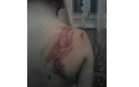 Стало известно, как накажут заведующую садиком, где ребенка обожгли супом