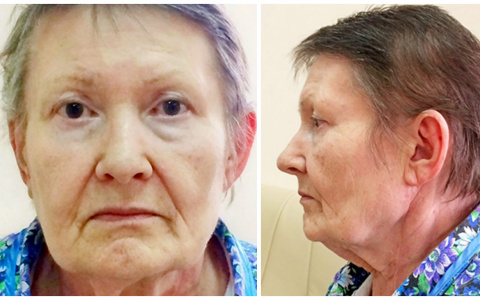 В Кировской области ищут родственников женщины, которая потеряла память