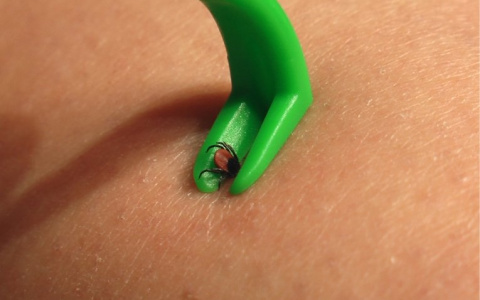 Как правильно удалить клеща?