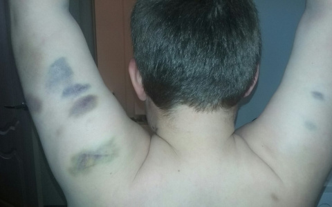 В детском лагере в Кировской области избили школьника