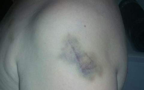 Директор лагеря в Кировской области прокомментировал драку школьников