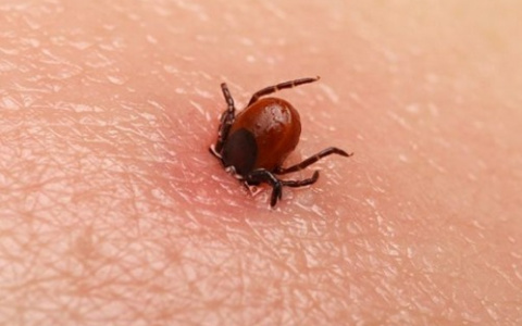 Что делать, если укусил клещ: краткая инструкция