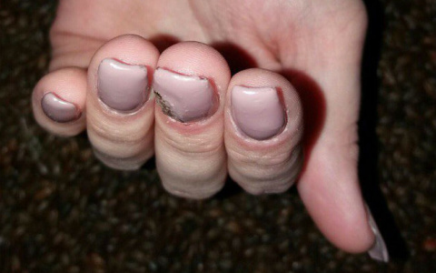 Кровавые ногти и желтые волосы: 9 фото ужасов кировской индустрии красоты