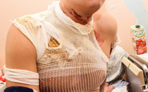 У Нового моста от костра загорелся рыбак