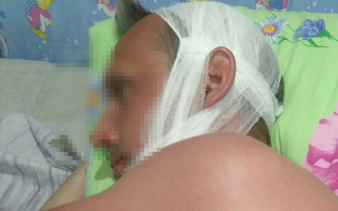 Руководство «Гордормостстроя» поможет избитому дорожнику