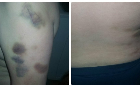 Прокуратура проверила лагерь в Кировской области, где избили ребенка