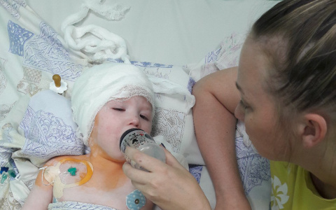 Немецкий профессор бесплатно сделал сложнейшую операцию мальчику из Кирова