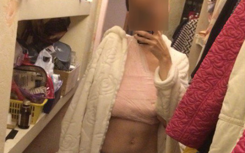 В троллейбусе кировчанка дверями серьезно повредила плечо