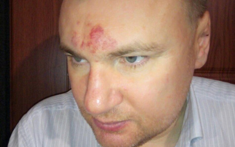 В Кирове избили юриста Антона Долгих