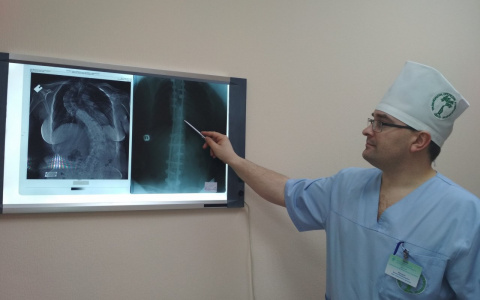 В Кирове пациентке провели несколько сложнейших операций по удлинению конечностей