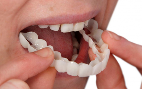 Какой зубной протез подойдет именно вам?