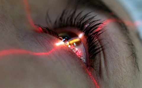 Лазерная коррекция. Выбирайте с умом!