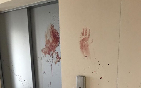 Утром в районе Зонального жильцы нашли окровавленный труп мужчины