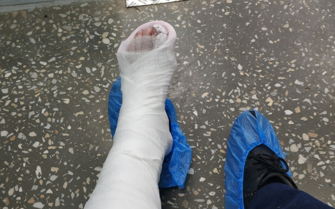 Кировчанин собирается судиться с администрацией города из-за перелома