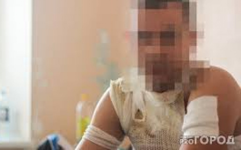 В Кирове мужчина при приготовлении пищи получил серьезные ожоги и попал в больницу