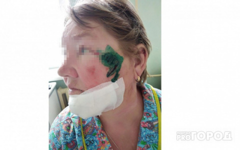 В Кировской области собака бойцовской породы покалечила пенсионерку