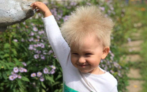 «Таких людей всего 100 в мире»: история малыша из Кирова с уникальными волосами
