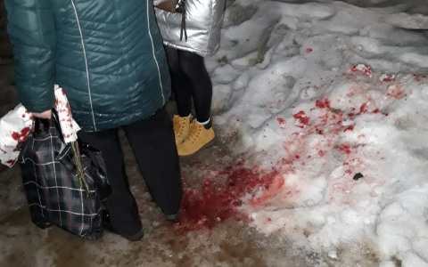 В Кирове пенсионерка поскользнулась и разбила нос