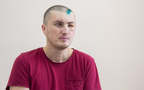 В Кирове 35-летний мужчина с инсультом сам приехал в областную больницу