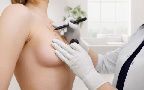 Силикон лопнет в самолете? Кировчанкам рассказали, из чего на самом деле делают имплантаты