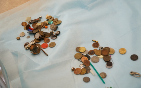 Монетки, детали машинок и булавки: кировский врач о том, что попадает детям в желудок