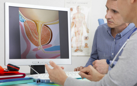 ПроЖиви долго: кировские врачи рассказали правду о болезнях урологии