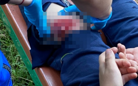 "Ногу разорвало до кости": у детской площадки в Кирове ребенок напоролся на арматуру