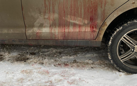 В Кирове таксист с ножевым ранением смог найти росгвардейцев и сообщить о нападении