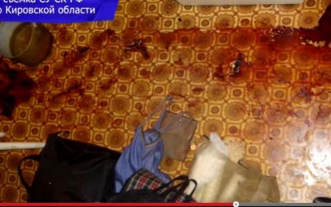 Кировчанина привезли в больницу с 50 ножевыми ранениями: известны подробности