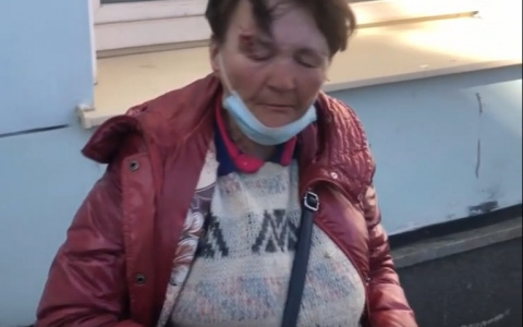 В Кирове на железнодорожном вокзале таксист жестоко избил бездомную женщину