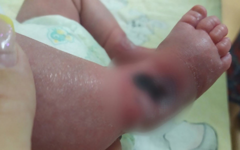 В кировской больнице новорожденному ребенку травмировали ногу: следком начал проверку