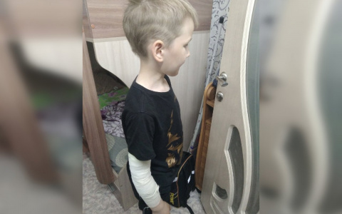 В Кировской области на первоклассника напала бездомная собака: ребенку наложили 9 швов