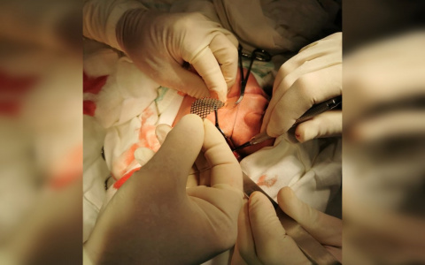 Кировские врачи спасли пациенту глаз, который висел на нерве