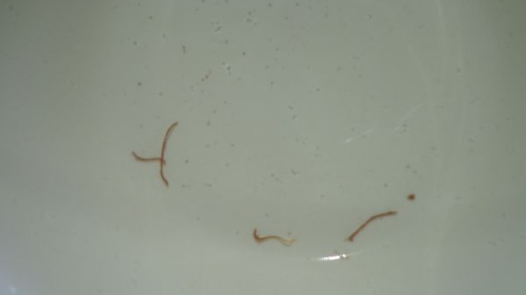 Черные черви в воде. Гельминты маленькие коричневые червячки. Красные червячки в Кале. Маленькие красные червячки.