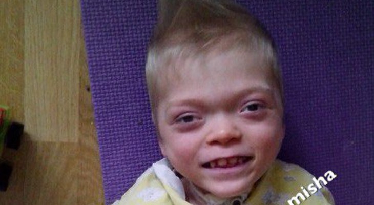 7-летний Миша из Кирова начал терять зрение из-за редкой генетической болезни
