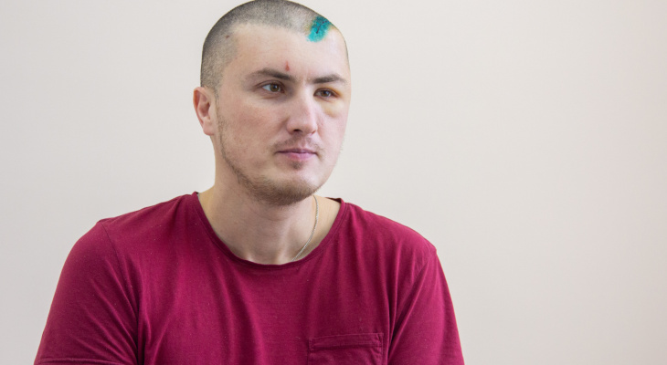 В Кирове 35-летний мужчина с инсультом сам приехал в областную больницу
