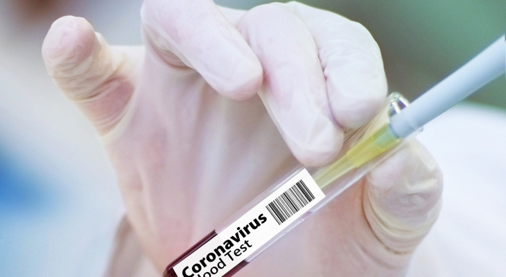 В Кировской области будут проверять тесты на коронавирус жителей республики Коми